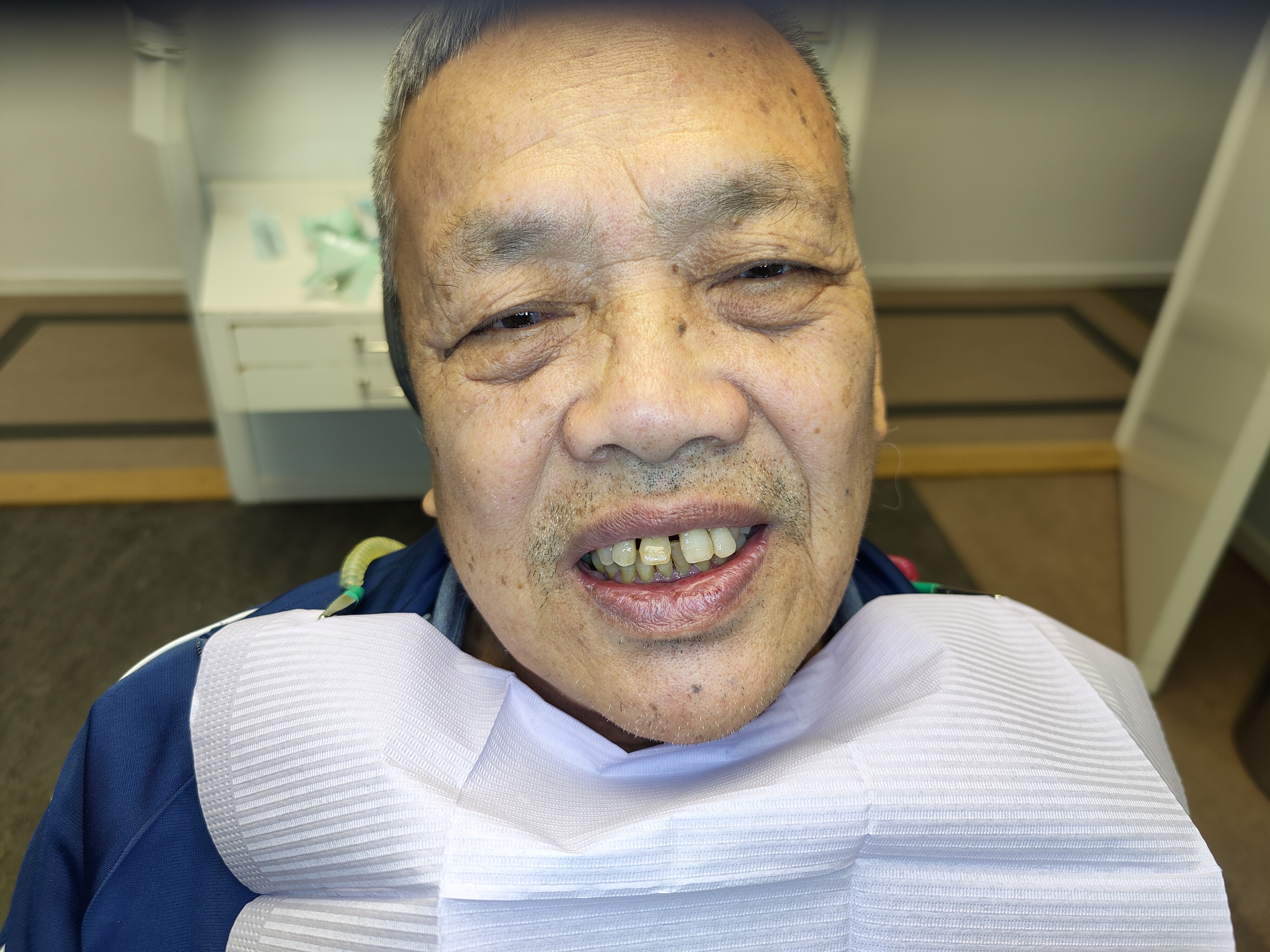 Before dental treatment