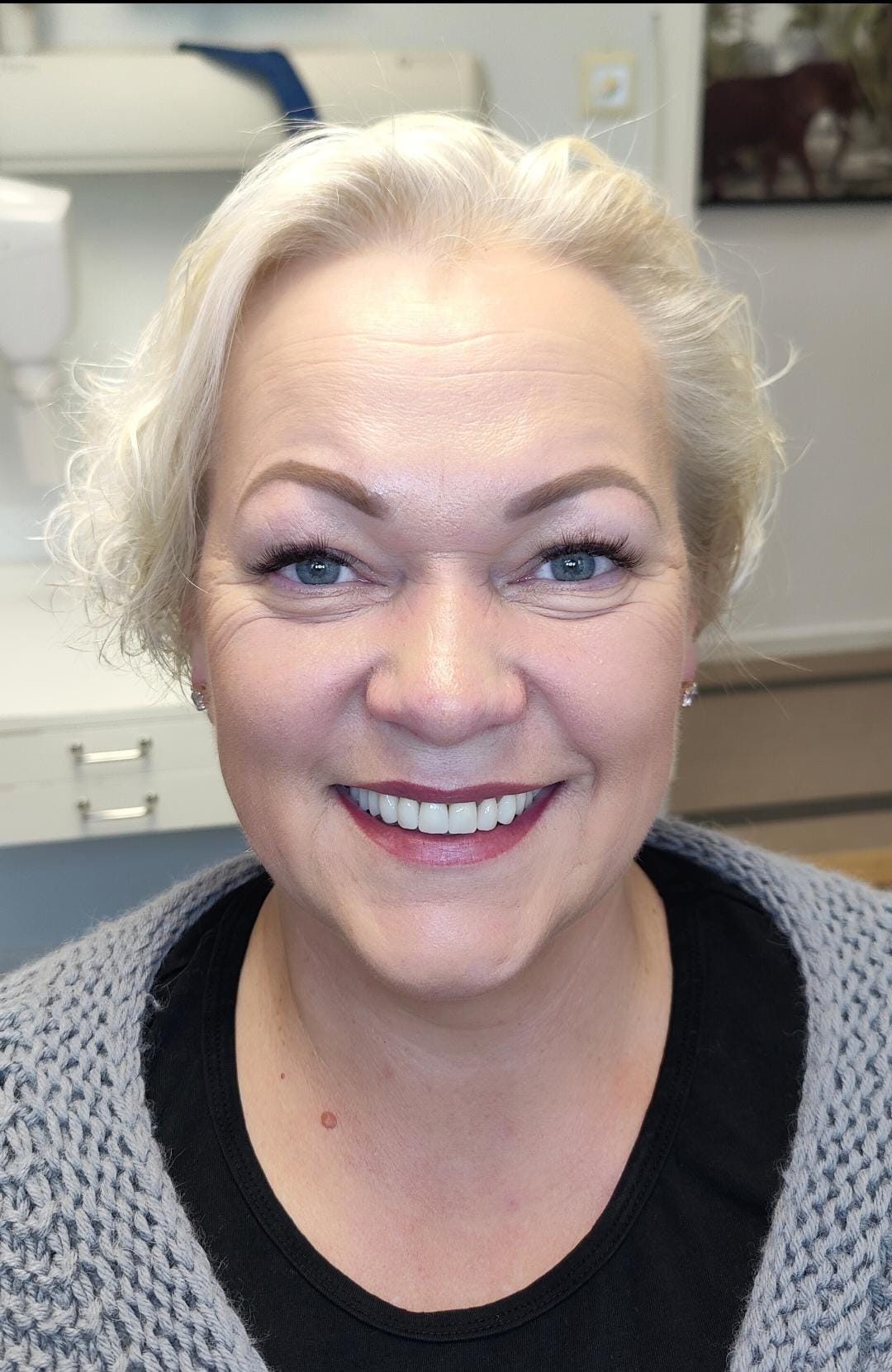 After dental treatment