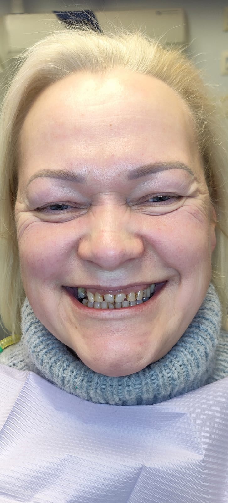 Before dental treatment