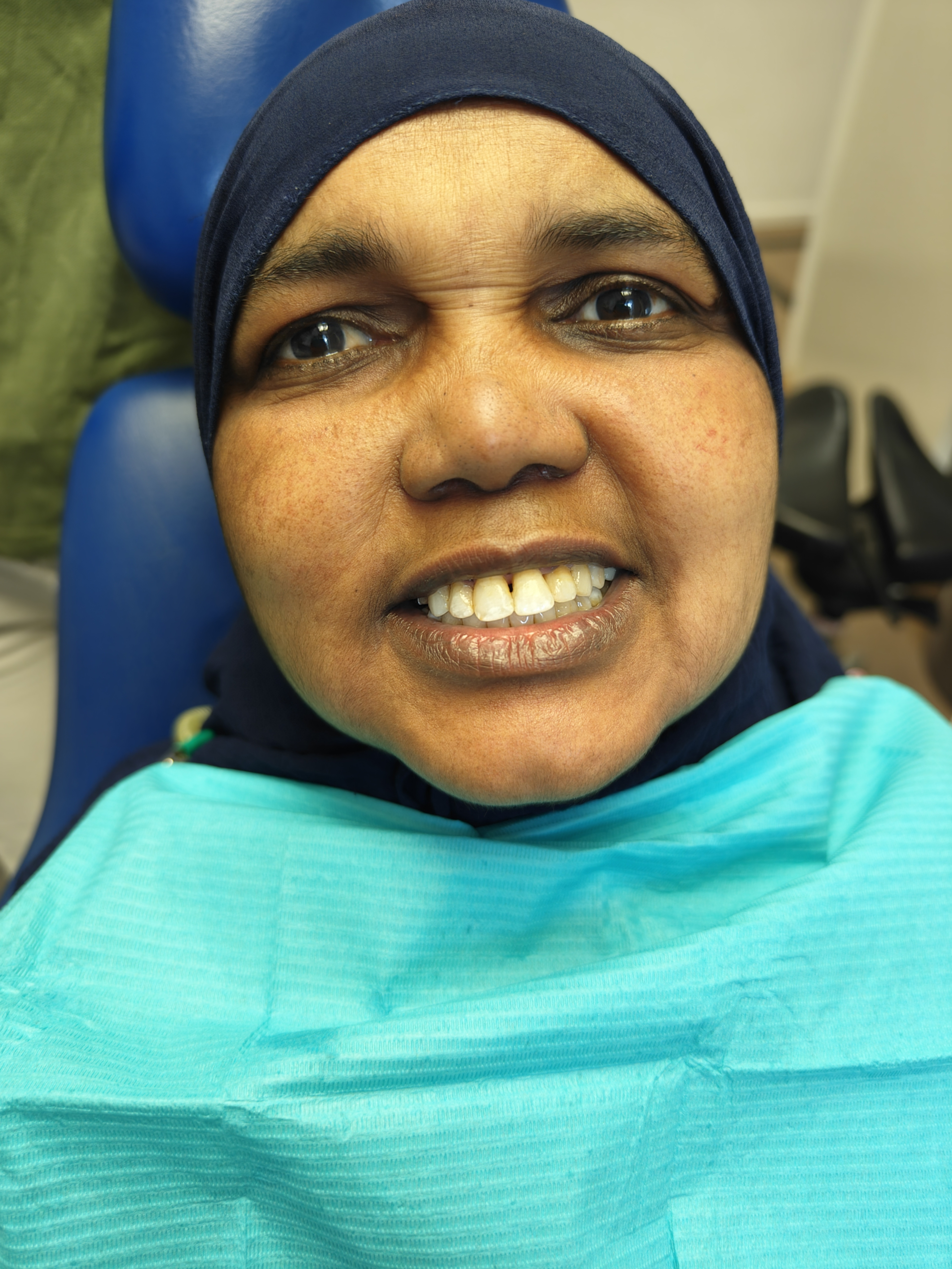 After dental treatment