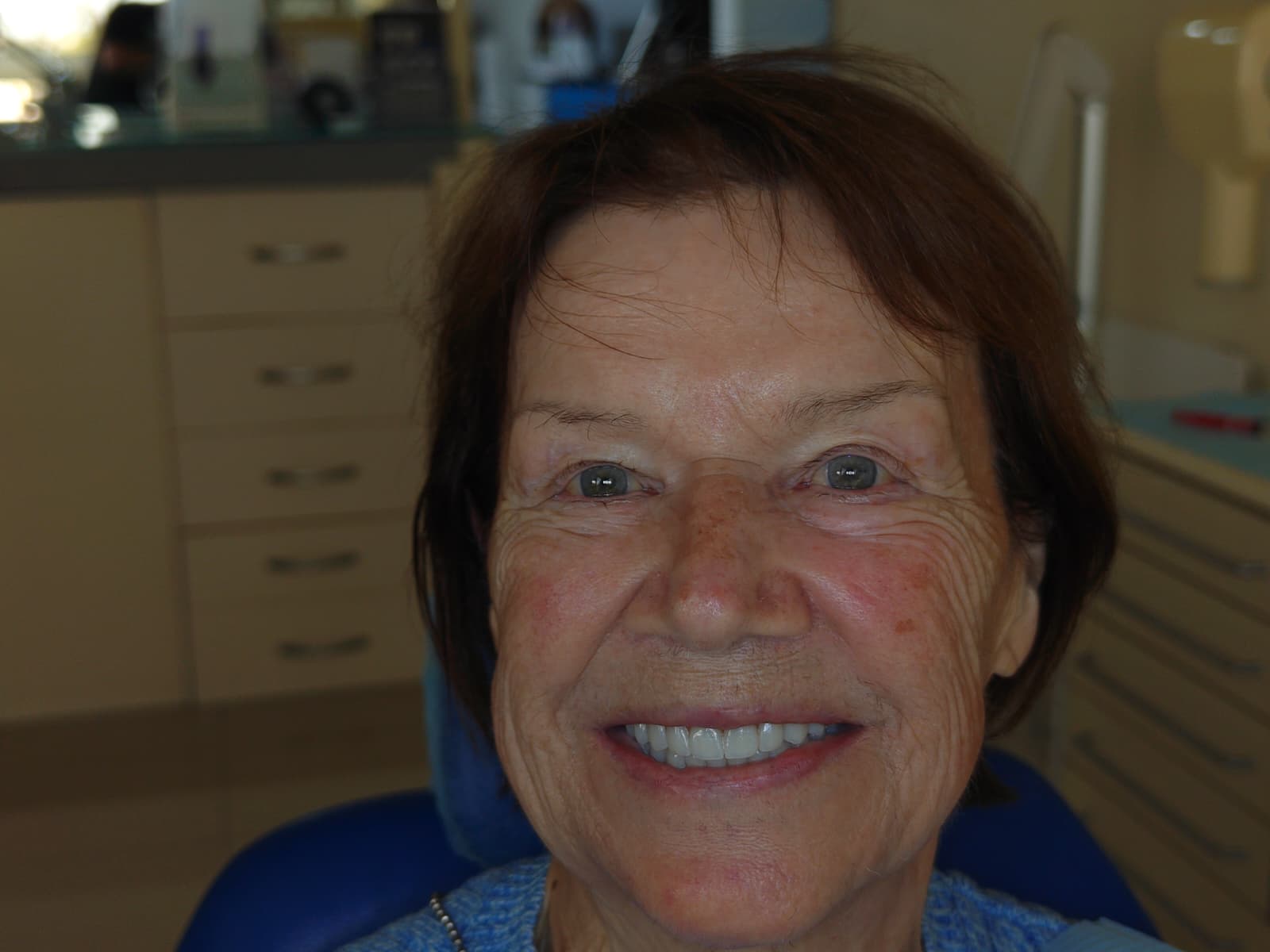 After dental treatment